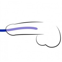 Набор силиконовых уретральных бужей Dilator Set Набор силиконовых уретральных бужей Dilator Set